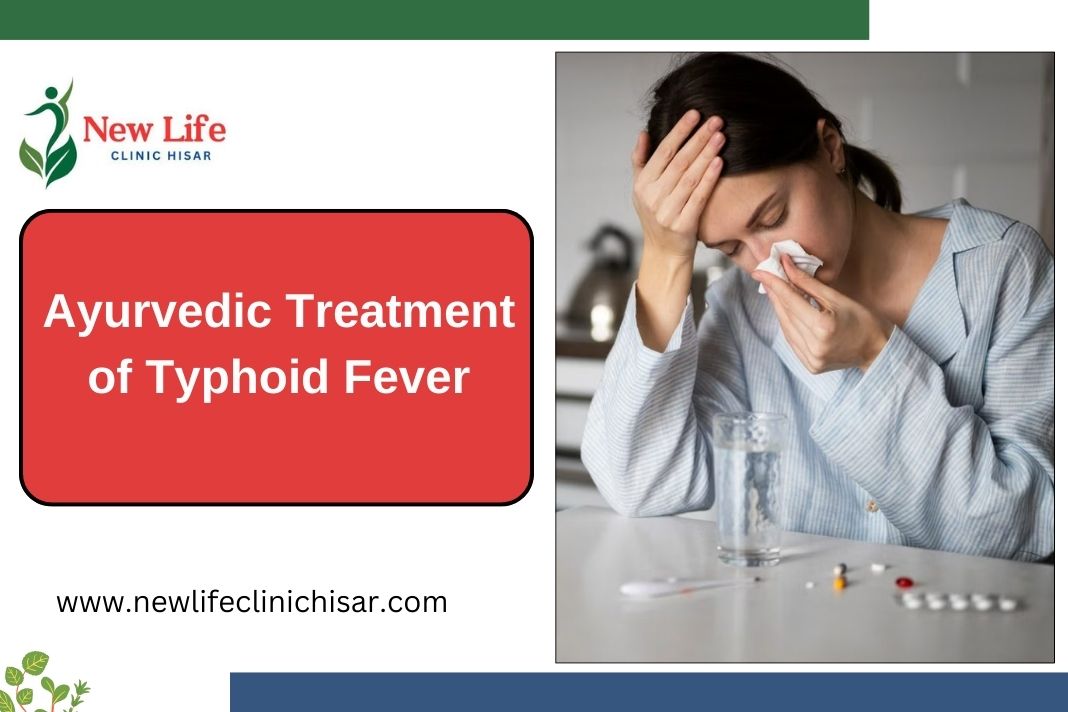 Ayurvedic Treatment of Typhoid Fever: Natural Healing Through Ayurveda in Hisar-125001, Haryana