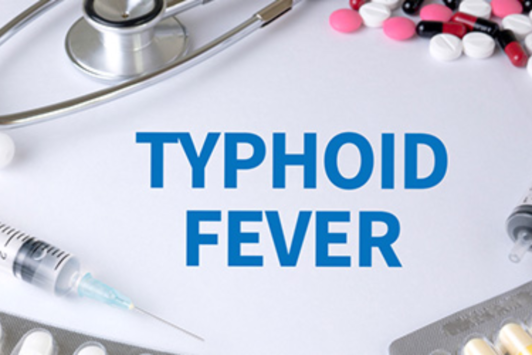 Ayurvedic Treatment Approaches for Typhoid Fever